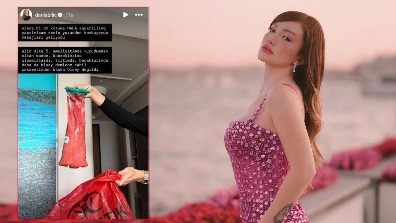 Vücudundan Çıkan Dolgu Herkesi Şaşkına Çevirdi! 14 551790